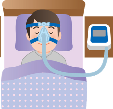 イラスト：CPAP